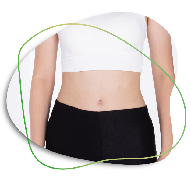 Tummy Tuck In Dubai