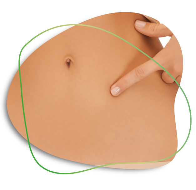 Umbilicus Reconstruction In Dubai