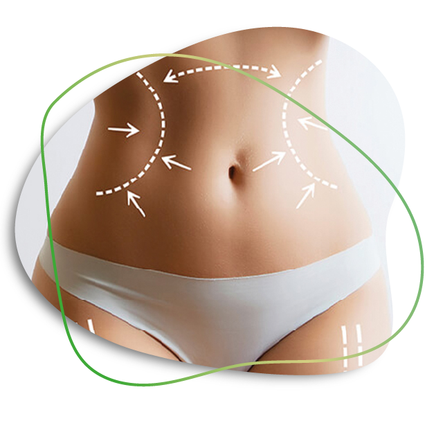 Abdomen Liposuction