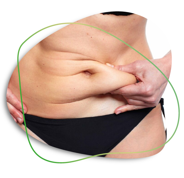 Abdomen Liposuction