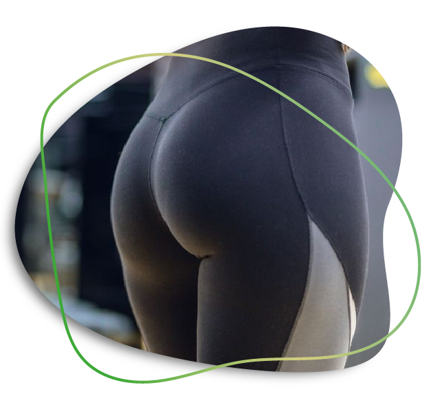 Butt Augmentation