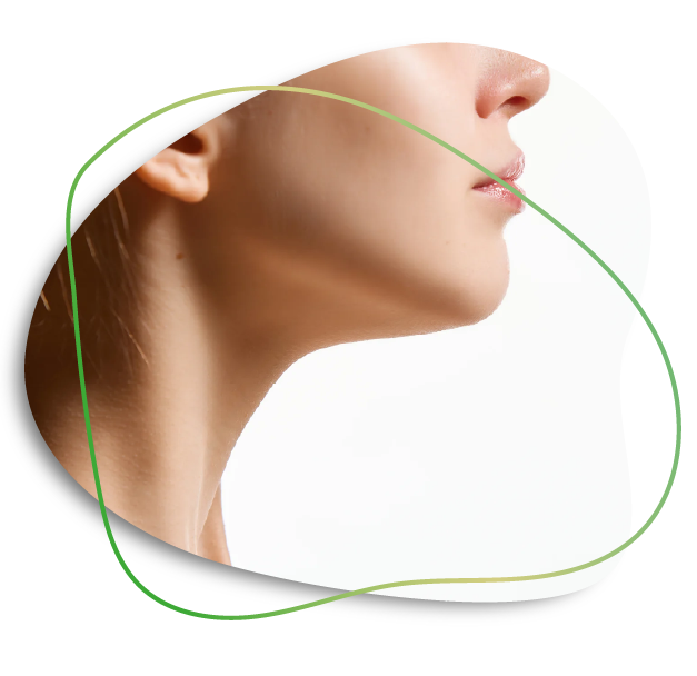 Chin Liposuction