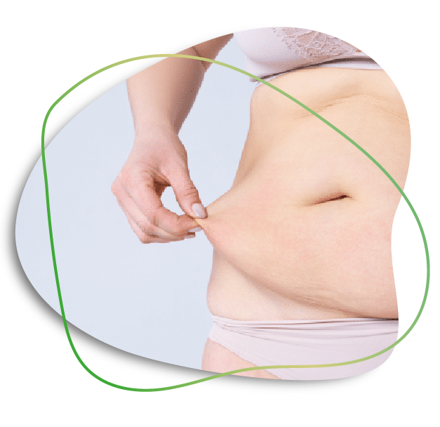 Lipo Abdominoplasty