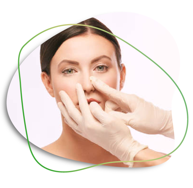 Rhinoplasty Tip Reshaping in Dubai