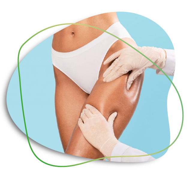 Thigh Liposuction In Dubai