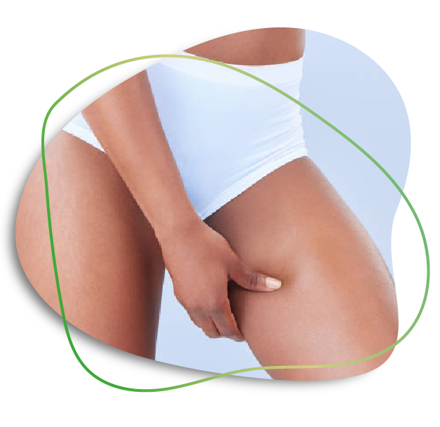 Thigh Liposuction In Dubai